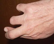 180px-Crossed_fingers_P1442.jpg
