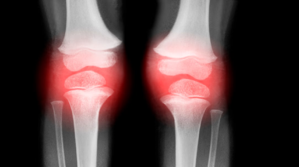 knees.png